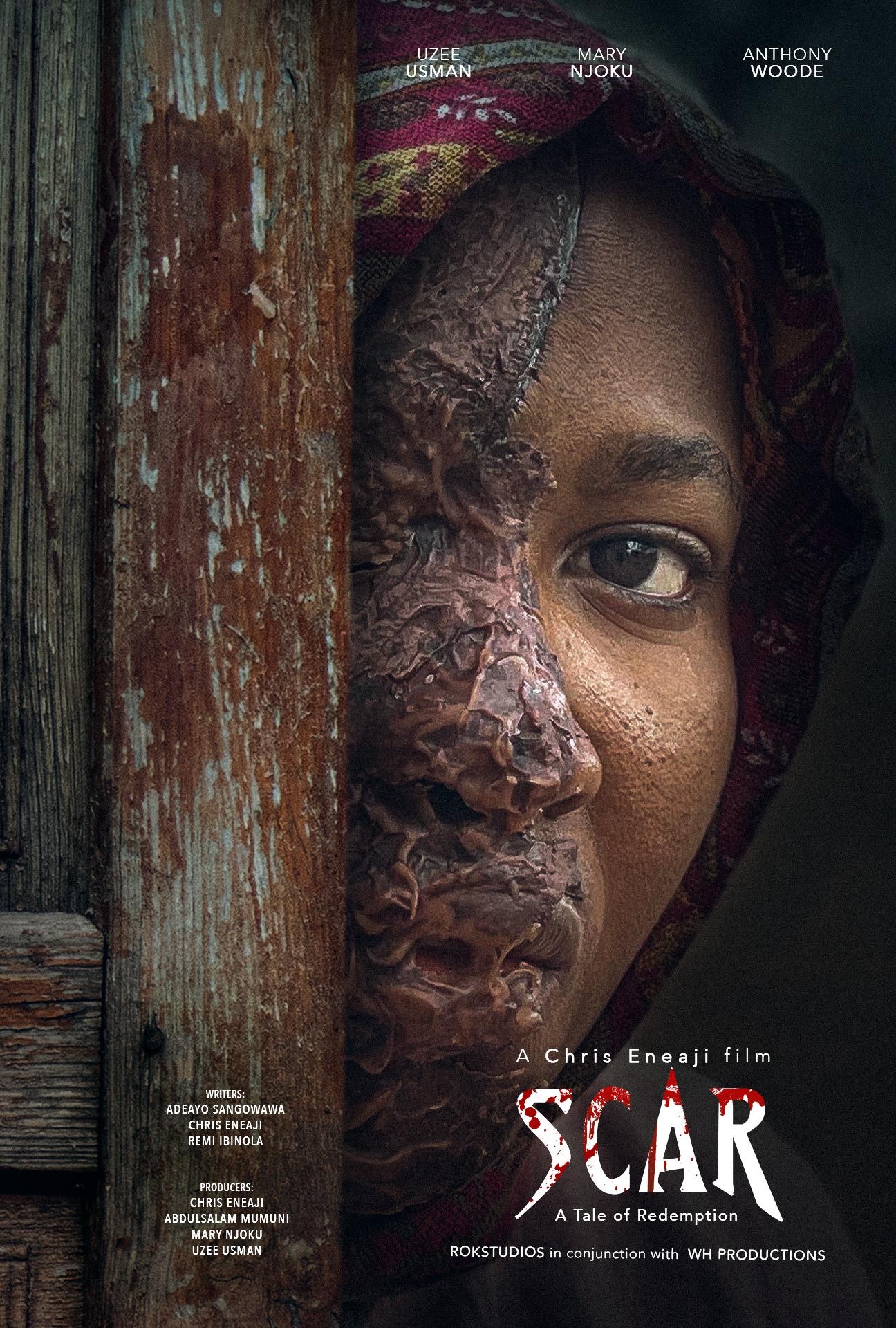 Scar